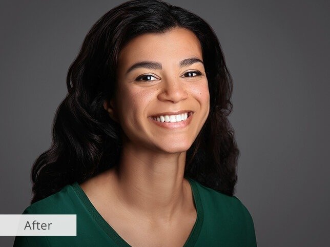 imgi_35_retouching-headshots-photos-after-3-wh960